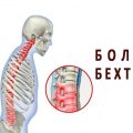 Псориатический спондилоартрит