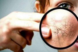 Рецепты народной медицины для лечения экземы в домашних условиях