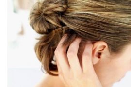 Что делать при обострении псориаза при беременности?