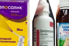 Псориаз на голове