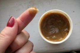 Лечение псориаза солидолом, как мазать в домашних условиях