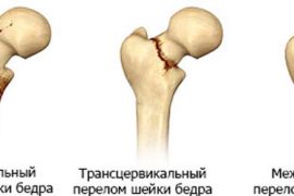 Сыпь на внутренней стороне бедра