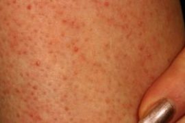Продукты содержащие глютен – таблица