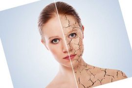 Из за чего может быть болезнь псориаз