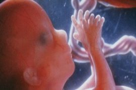Как лечить псориаз при беременности