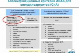 Периферический спондилоартрит что это такое