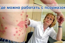 Почему с псориазом можно работать в общепите, и по какой причине делать этого не рекомендуется?