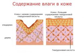 Кремы для лица с гиалуроновой кислотой: аптечные и приготовление дома