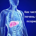 Диета при псориазе