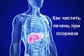 Диета при псориазе