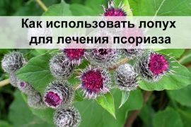 Лопух при псориазе