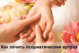 Особенности лечения псориатического артроза
