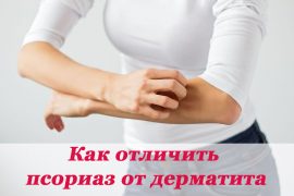 Основные отличия псориаза и дерматита
