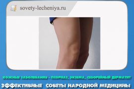 Кожные болезни ног: виды, фото, описание и лечение