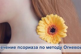 Метод лечения псориаза доктором огневой