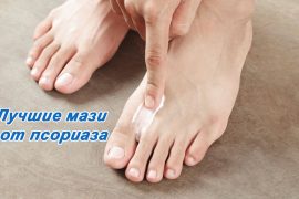 Лучшие лекарственные мази для лечения псориаза
