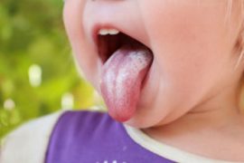 Может ли быть сухость во рту при остеохондрозе
