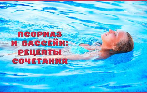 Псориаз и водные процедуры: можно ли ходить в бассейн и баню
