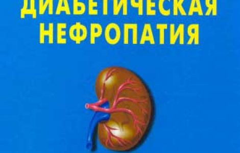 Диабетическая нефропатия: симптомы, стадии и лечение