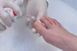 Звезды, у которых псориаз