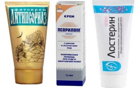 Кремы от псориаза – список лучших препаратов