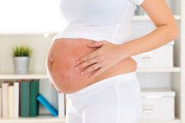 Псориаз волосистой части головы — особенности лечения