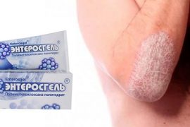 Полисорб от псориаза — что следует знать