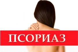 Санаторно-курортное лечение псориаза в России