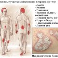 Основные причины и симптомы псориаза у взрослых