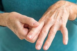 Симптомы псориатического артрита и способы лечения