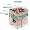 Алоэ от грибка ногтей на ногах и руках. Эффективно ли это средство?