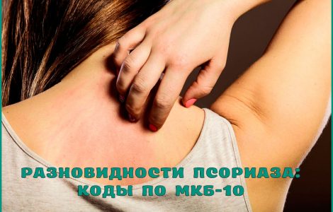 псориатическая артропатия код по мкб 10