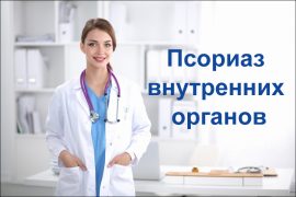 Что делать при поражении внутренних органов псориазом?