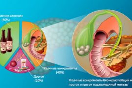 Как выглядит панкреатит