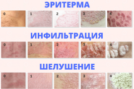 Индекс паси при псориазе расчет