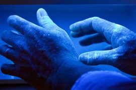 ПУВА-терапия при псориазе: плюсы и минусы, отзывы пациентов
